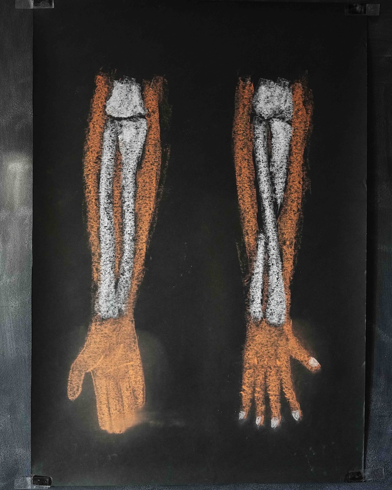 ８年　骨学　黒板画　腕の動き